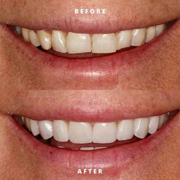cosmetic dentistry results from Rosehill Dentistry